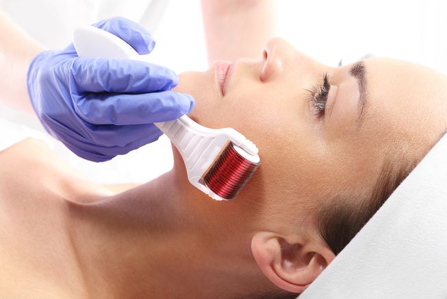 microneedling.jpg.653x0_q80_crop-smart